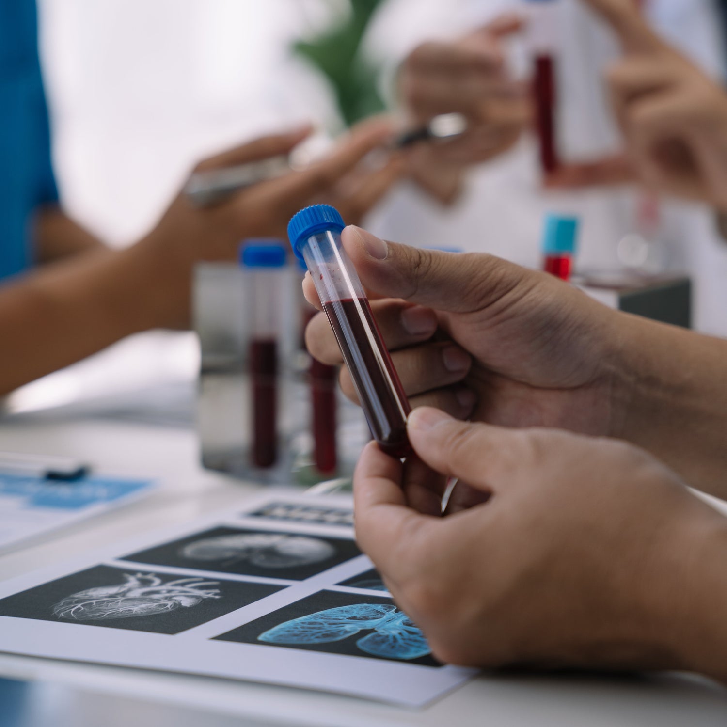 Person holding a test tube with blood sample in a laboratory setting